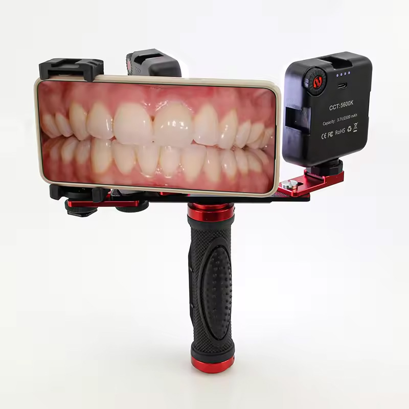 歯科用モバイル写真撮影LEDライト 口腔内写真・ビデオ用フラ - Photography Videos Free のレビューと価格